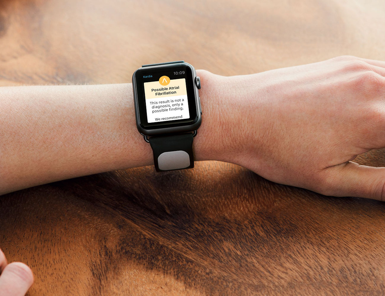 Kardia Band The EKG Strap for Apple Watch by AliveCor » Gadget Flow