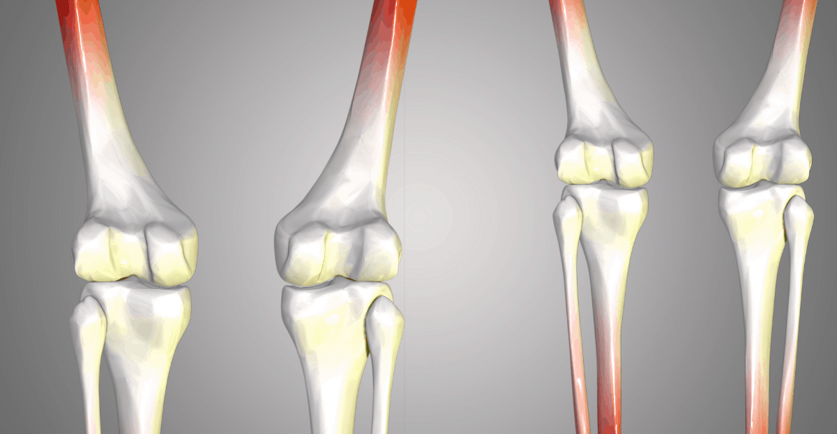 German Shepherd Joint Problems All You Need to Know The German