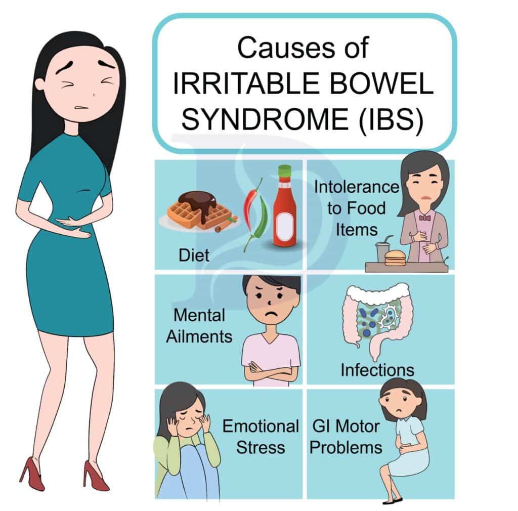 Managing Irritable Bowel Syndrome Digestive and Liver Health Specialists