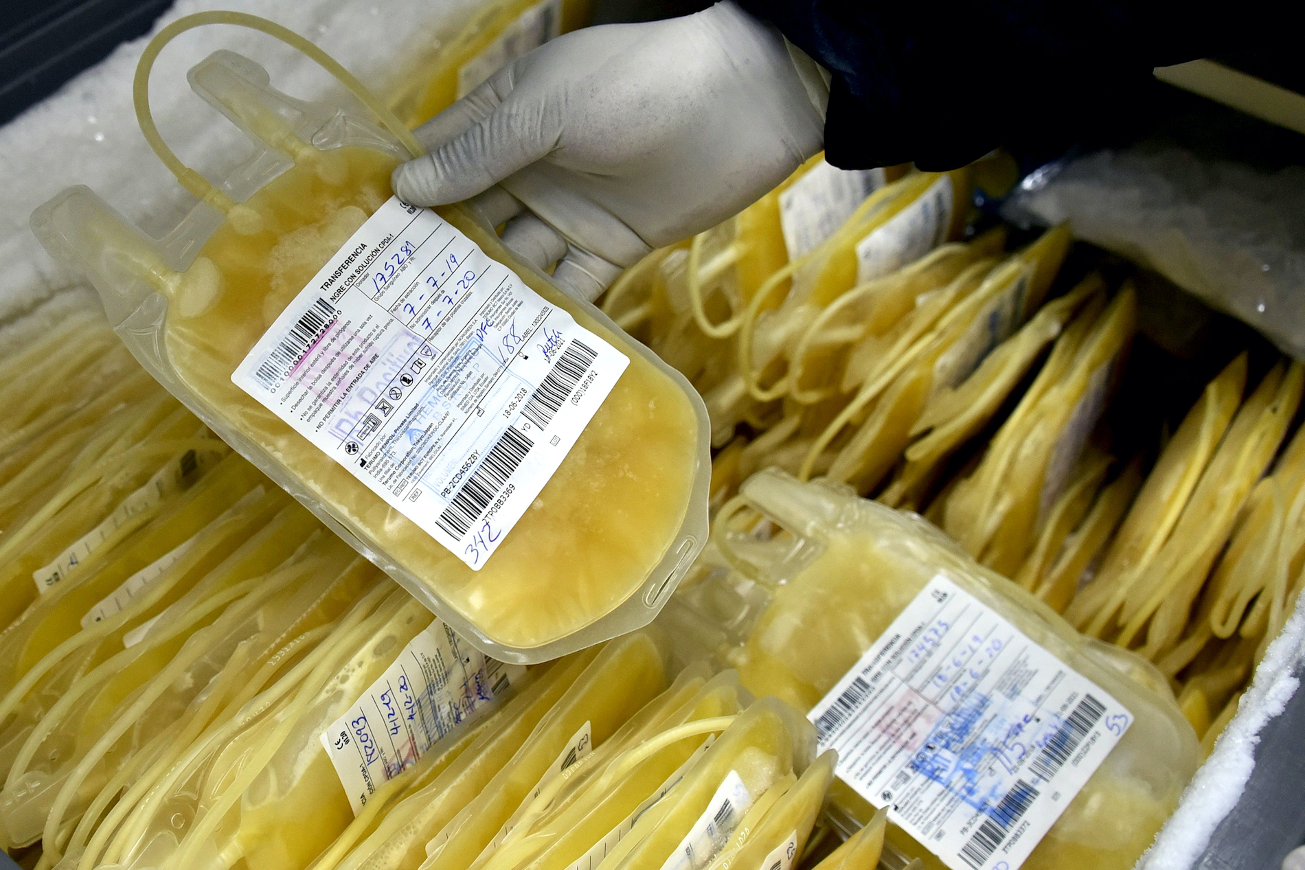 FDA Approves Blood Plasma to Treat COVID19