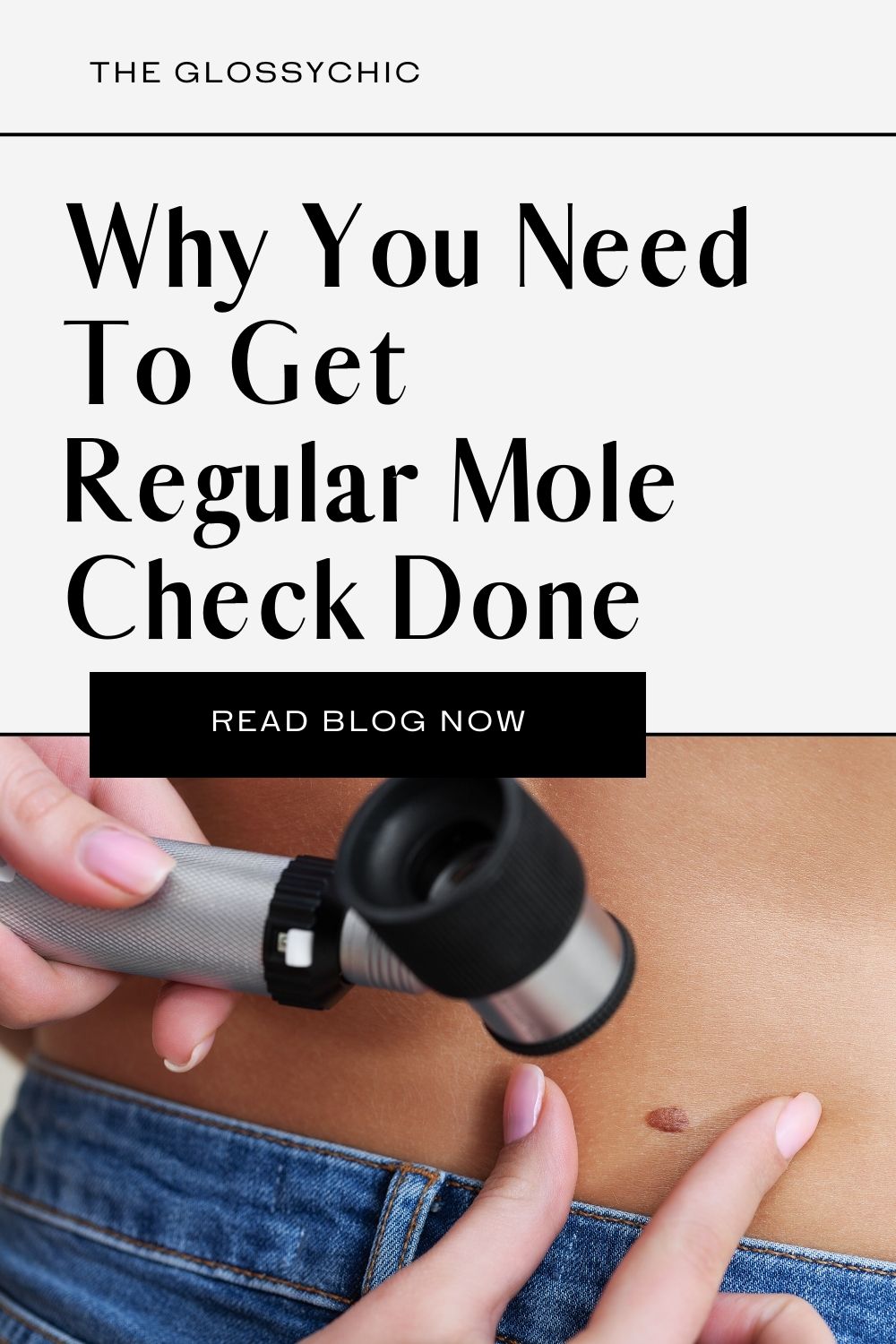 Why Do You Need To Get The Regular Mole Check Done? The Glossychic
