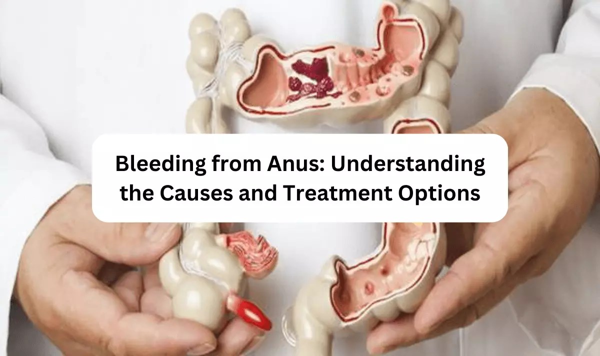Bleeding From Anus Understanding The Causes And Treatment Options