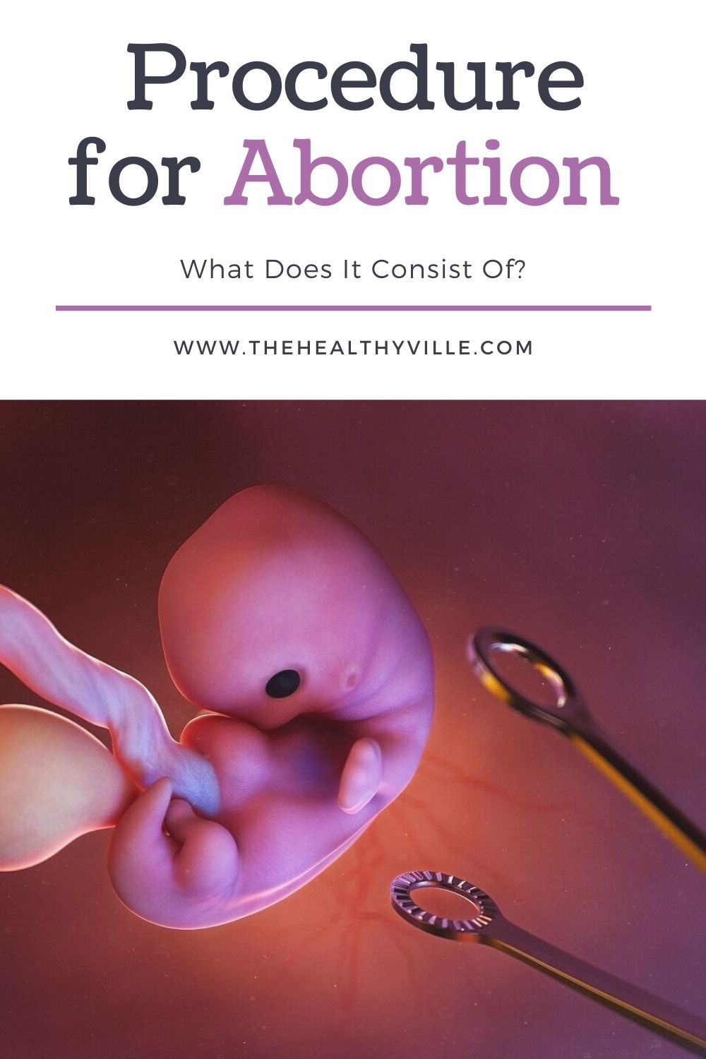 Procedure for Abortion What Does It Consist Of?