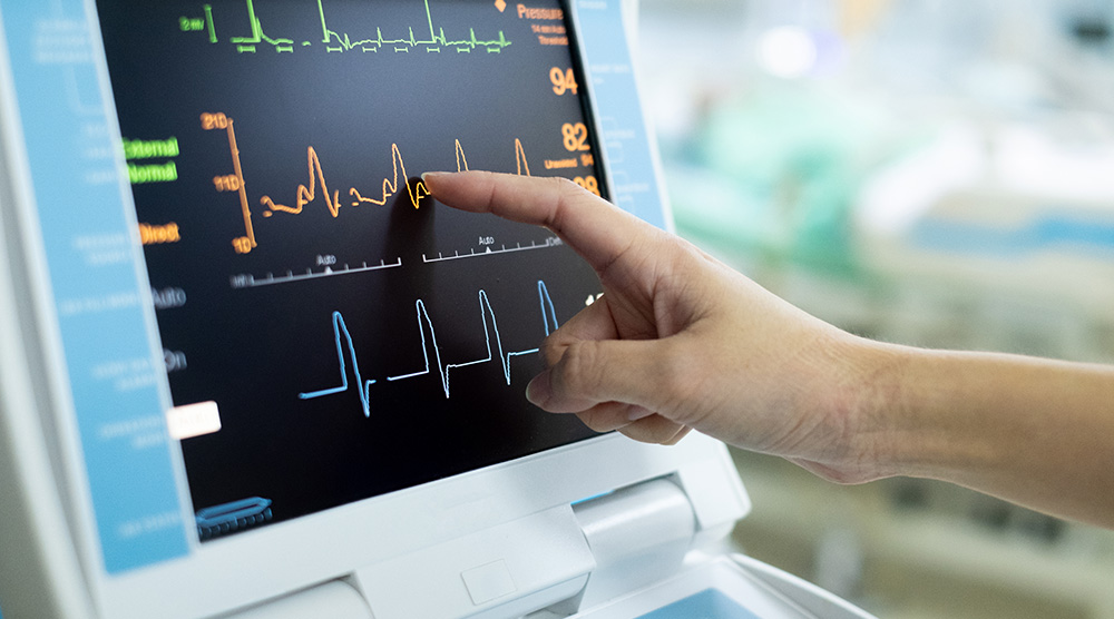 OnSite Cardiac Testing The Heart Group Fresno