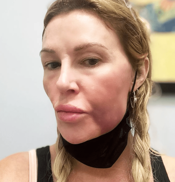 Brandi Glanville Burns Her Skin With Nair for This Reason The HyperHive