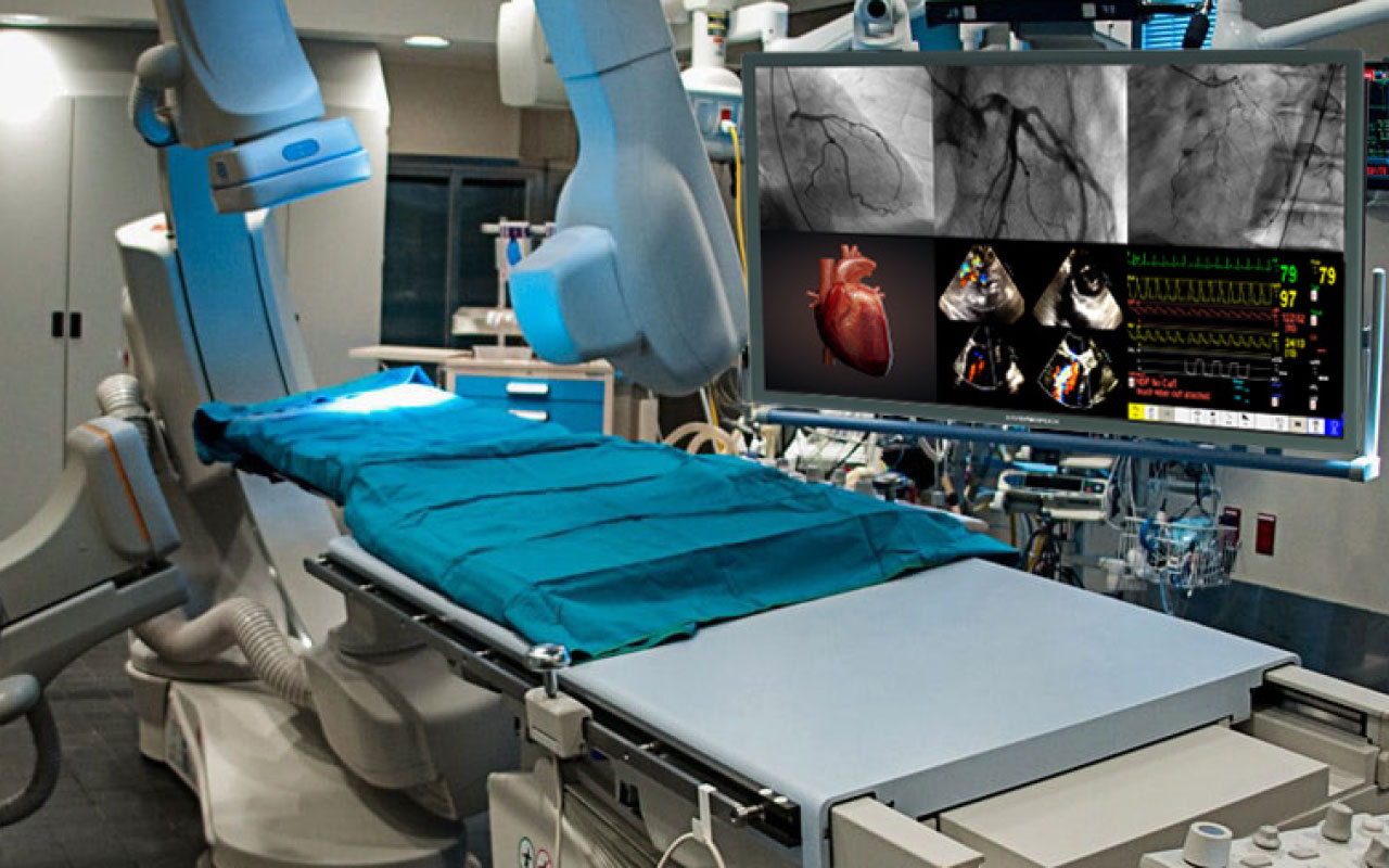 Cath/EP Lab and Hybrid OR Monitor Failure Rates Skyrocket ICE