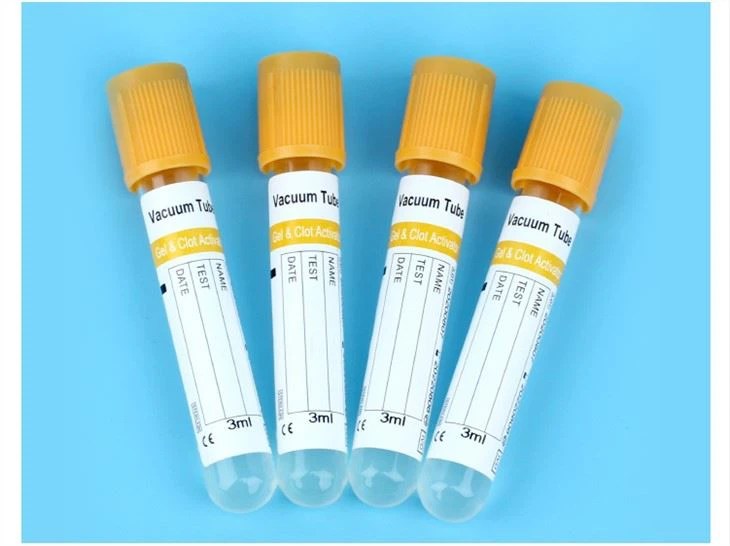 Unveiling the Marvel of Medical Science The Yellow Blood Collection