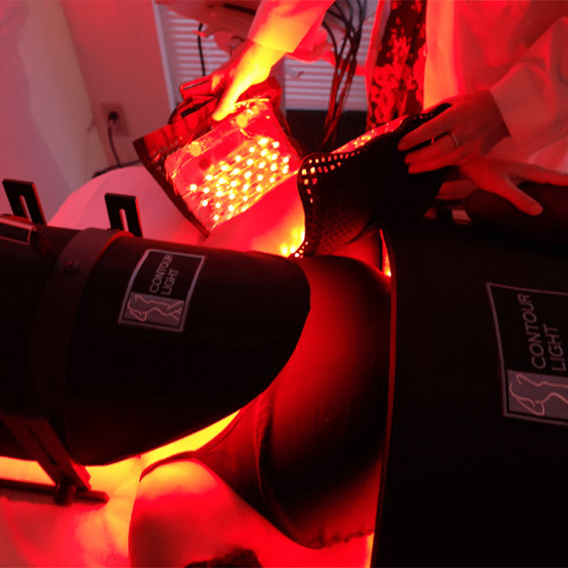 Body Sculpting The Laser Studio