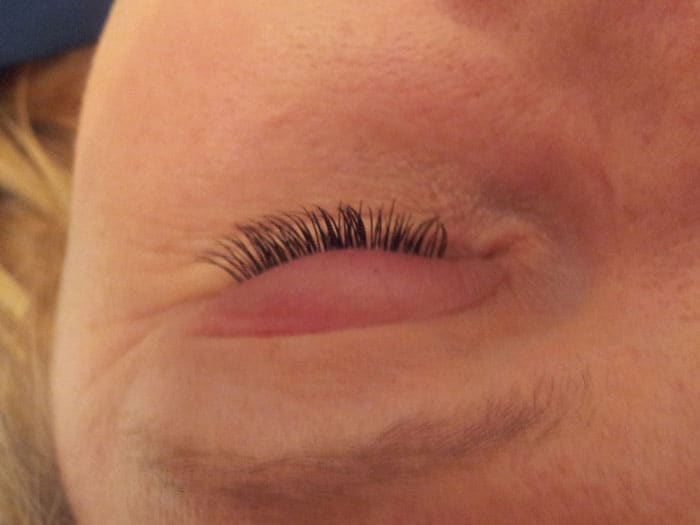 Eyelash Extensions Allergic Reaction