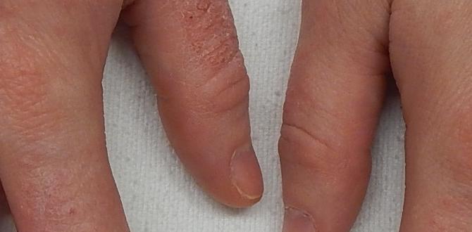 dermatitis on scalp dermatitis on scalp