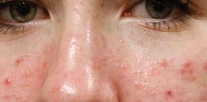 how to acne routine how to acne routine