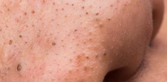 how to blackheads routine