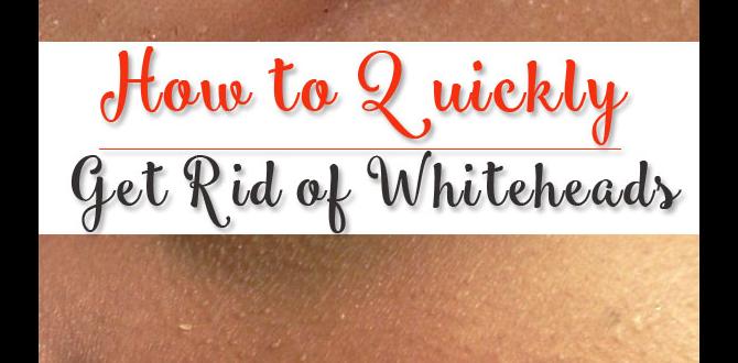 how to whiteheads tips how to whiteheads tips