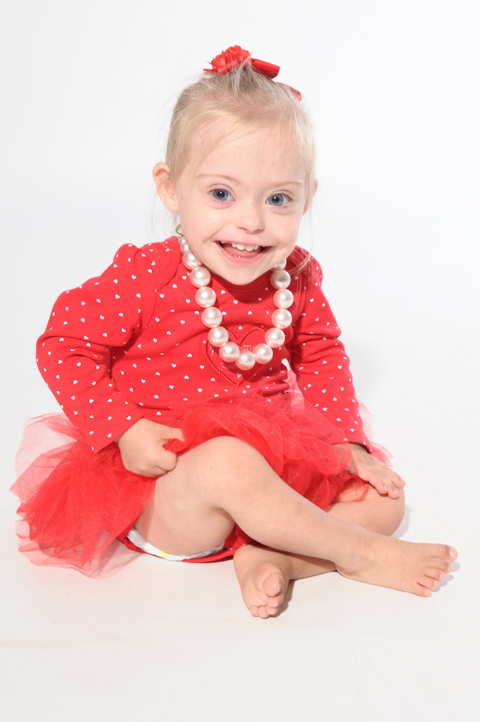 2yearold Down Syndrome Model Raises Awareness