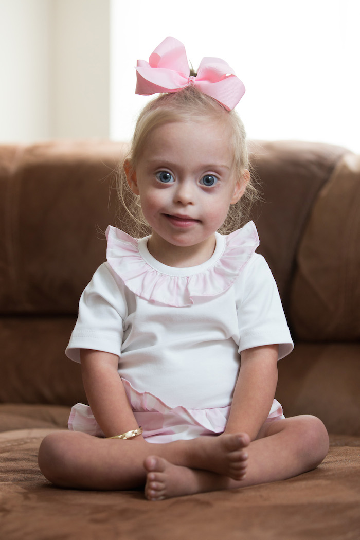 2yearold Down Syndrome Model Raises Awareness