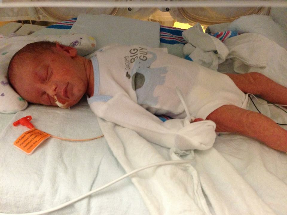 What Its Like to Have a Baby in the NICU