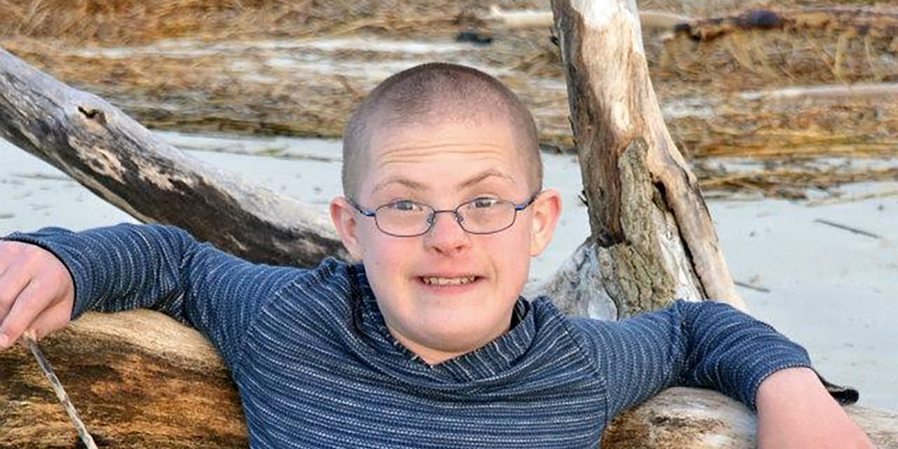 Adults With Down Syndrome How To Deal With Your Condition The Best