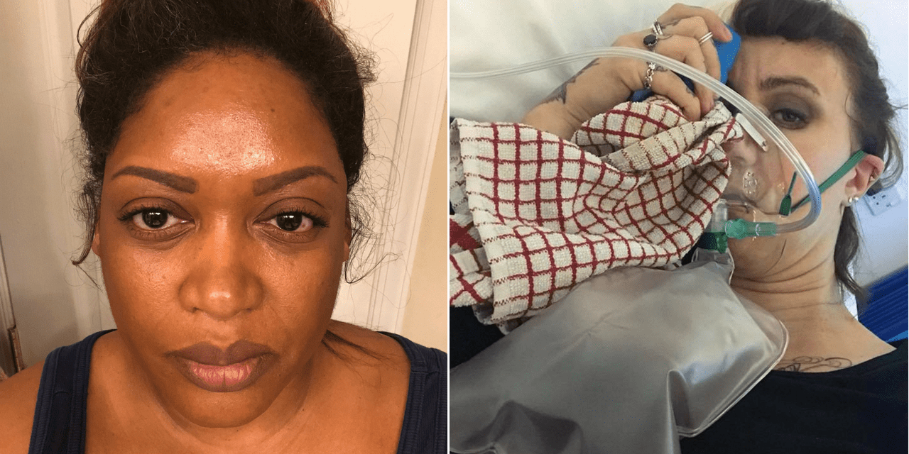 Swollen Eyes Headache Headache