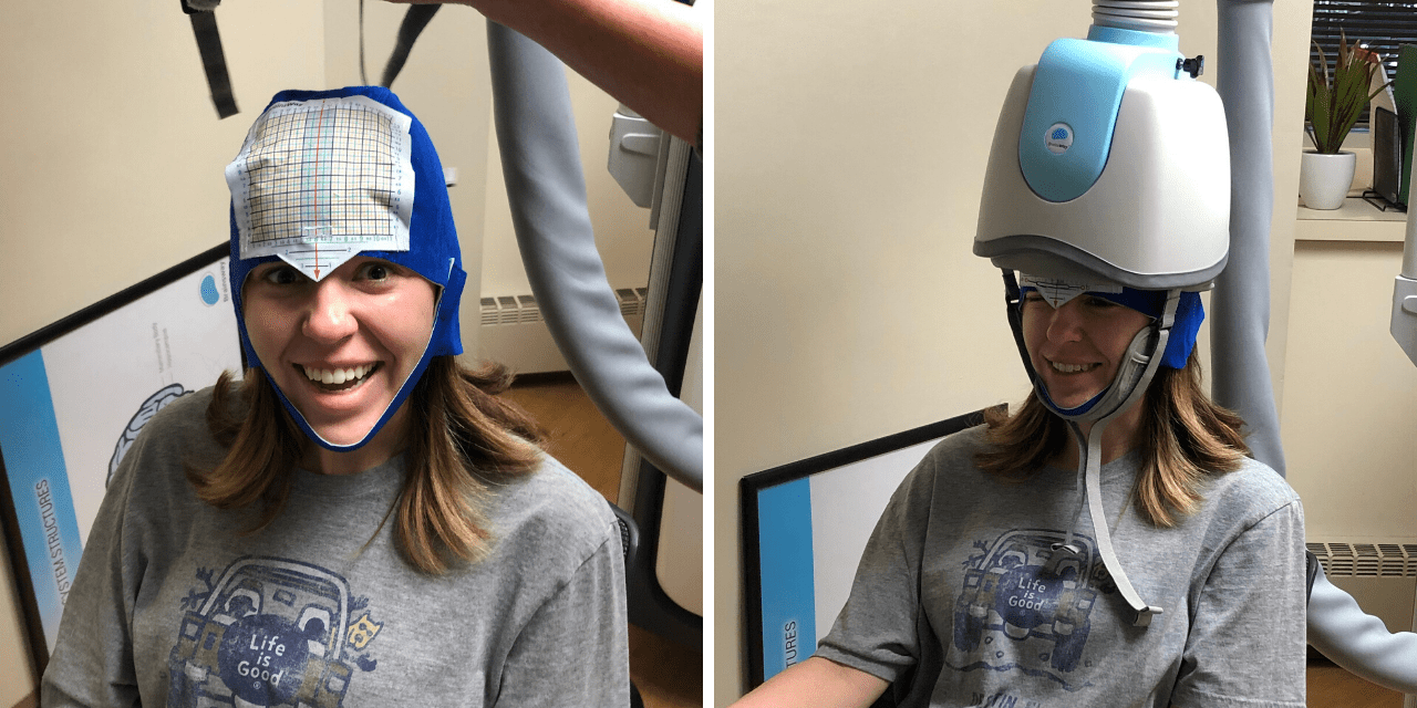 How Transcranial Stimulation Therapy Reduced My Depression