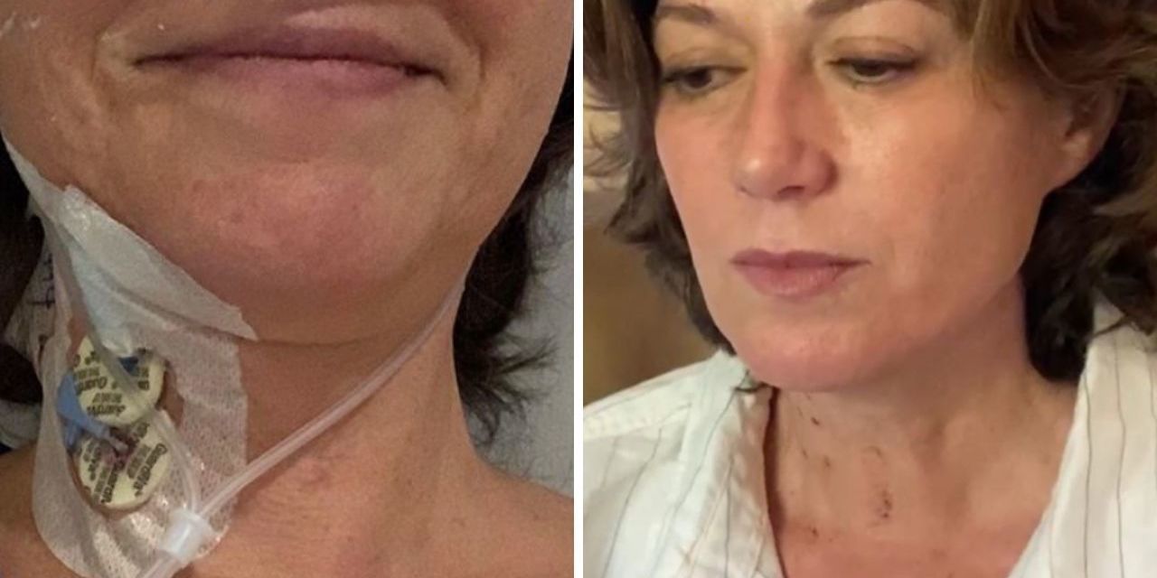 Amy Grant Shares Scar Photo After Emergency OpenHeart Surgery