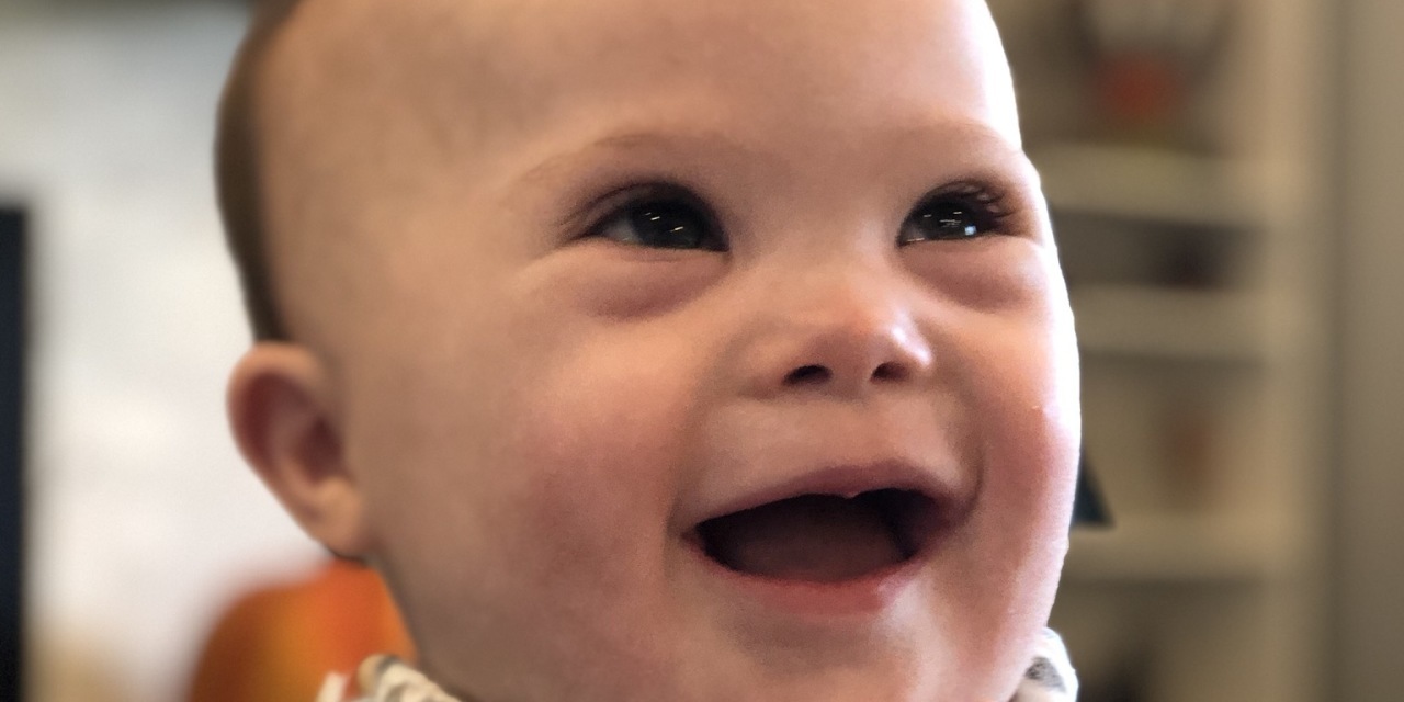 The Down Syndrome Awareness I Needed Before My Son Was Born The Mighty