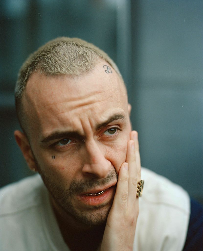 Joe Gilgun The MultiTalented Actor Who Captivates Audiences