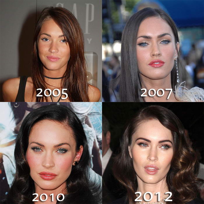 10 Most Flawless Cosmetic Surgeries that We Know of