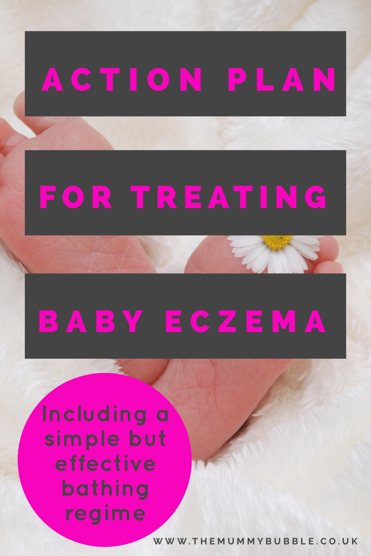Treating baby eczema The Mummy Bubble