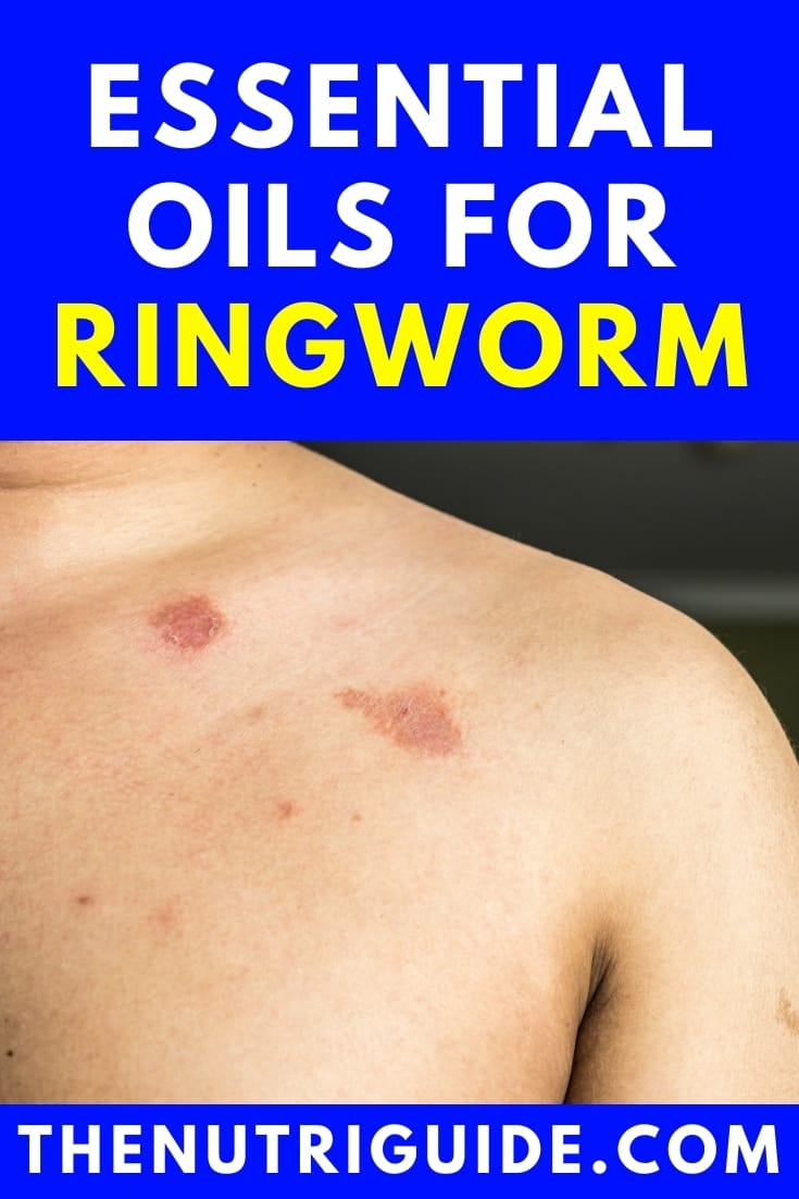 Essential Oils for Ringworm Naturally Fight Fungus