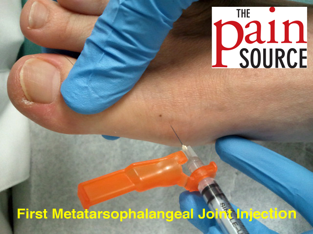 First Metatarsophalangeal Joint Injection Technique and Tips The