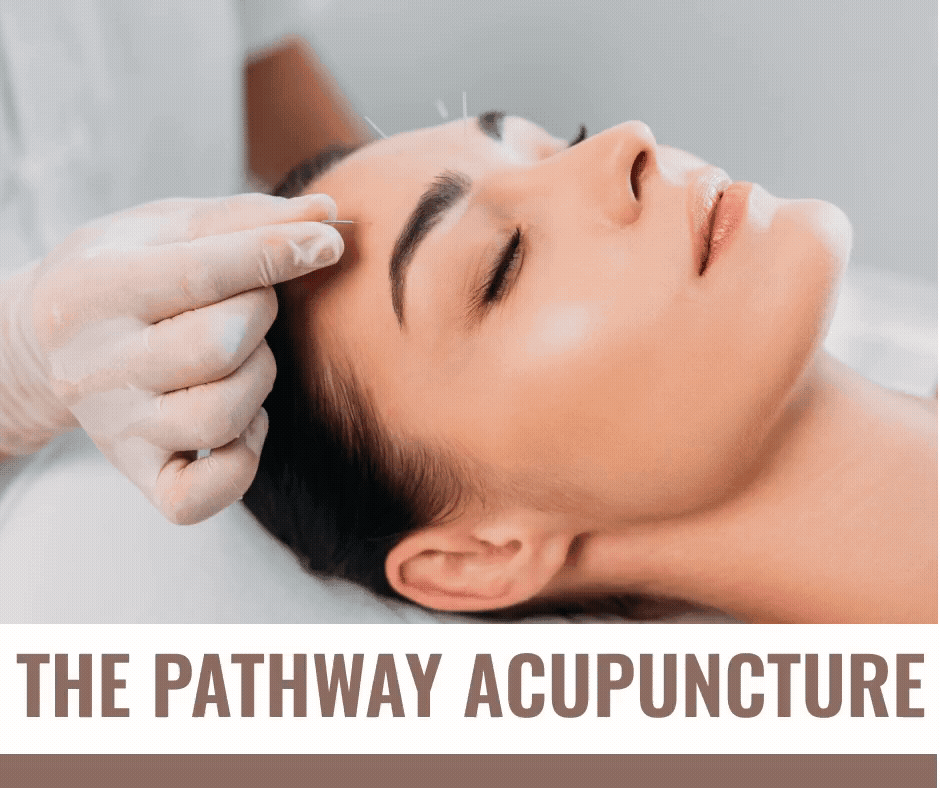 COSMETIC ACUPUNCTURE The Pathway Acupuncture