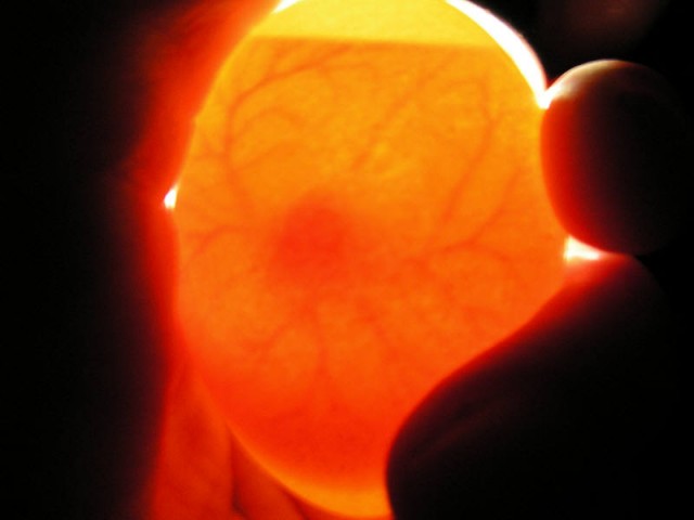 Chicken Egg Candling Guide The Poultry Guide