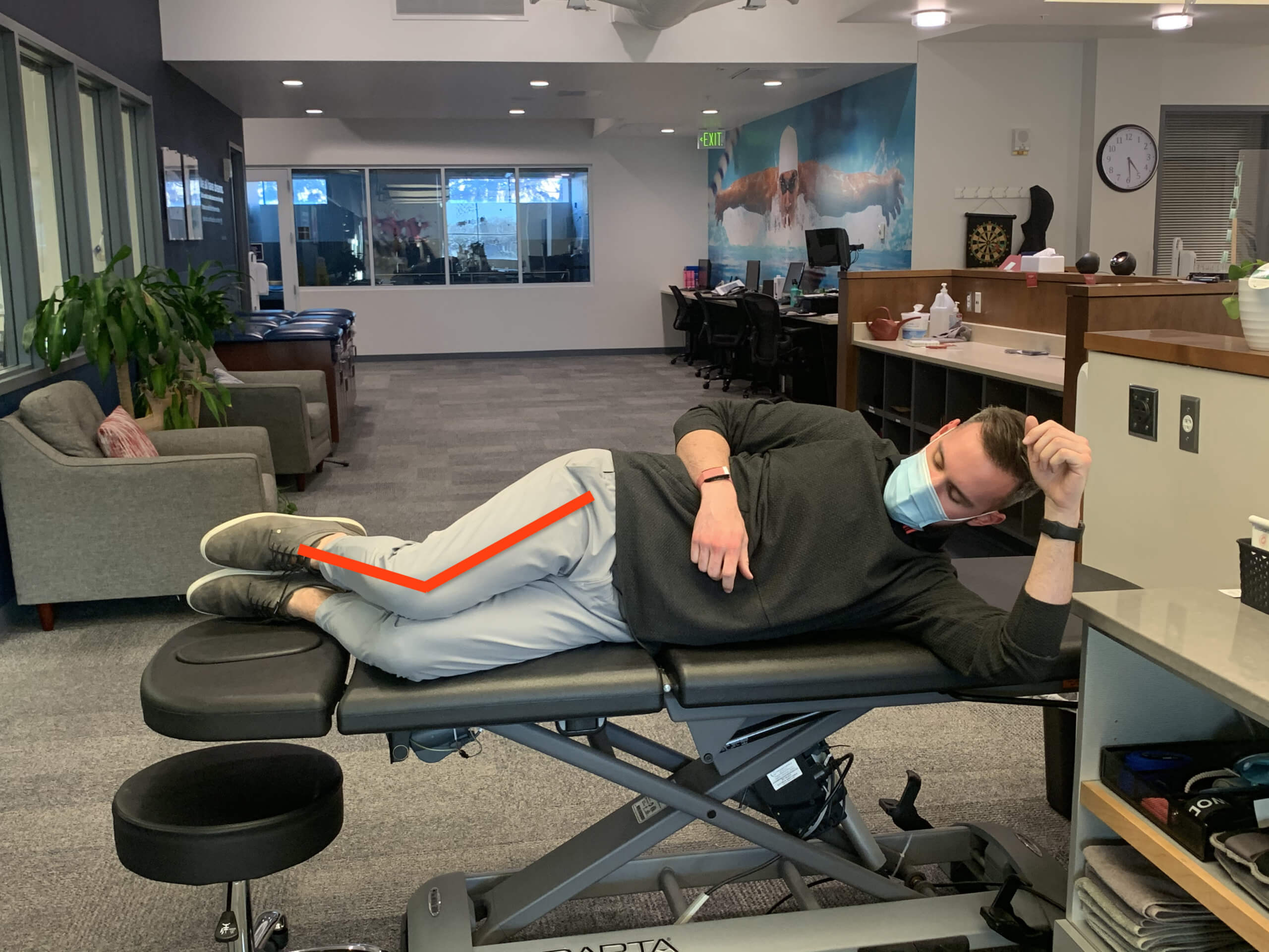 Hip Bursitis Versus Gluteal Tendinopathy [P]rehab