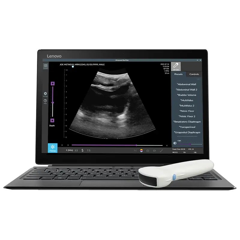 Bladder Ultrasound Imaging ST » The Prometheus Group®