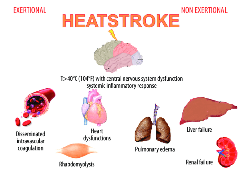 How does neurological impairment affected babies after they experienced