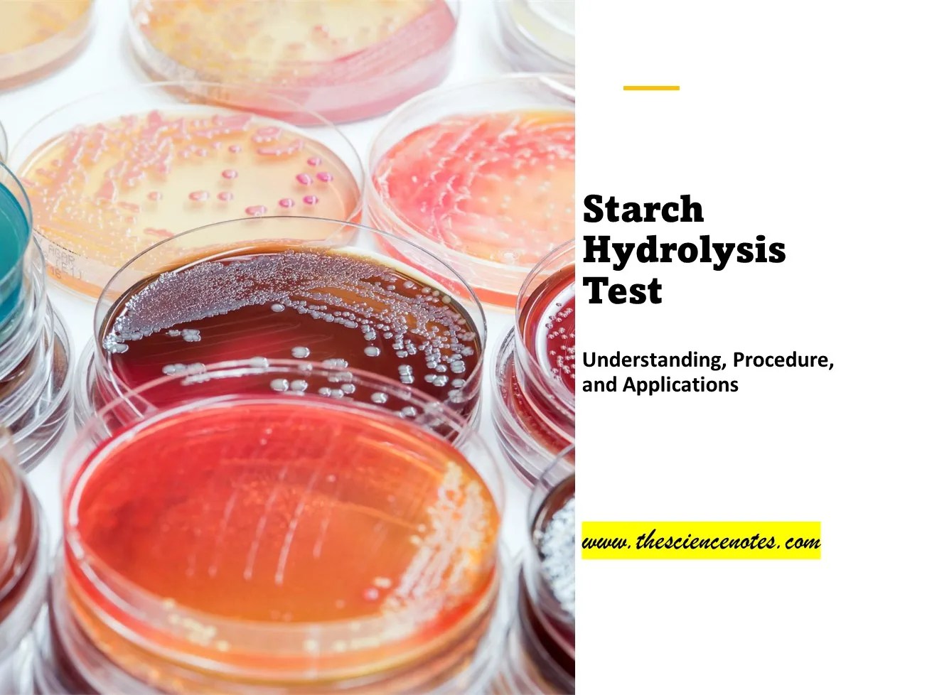 Starch Hydrolysis Test Understanding, Procedure, and Applications