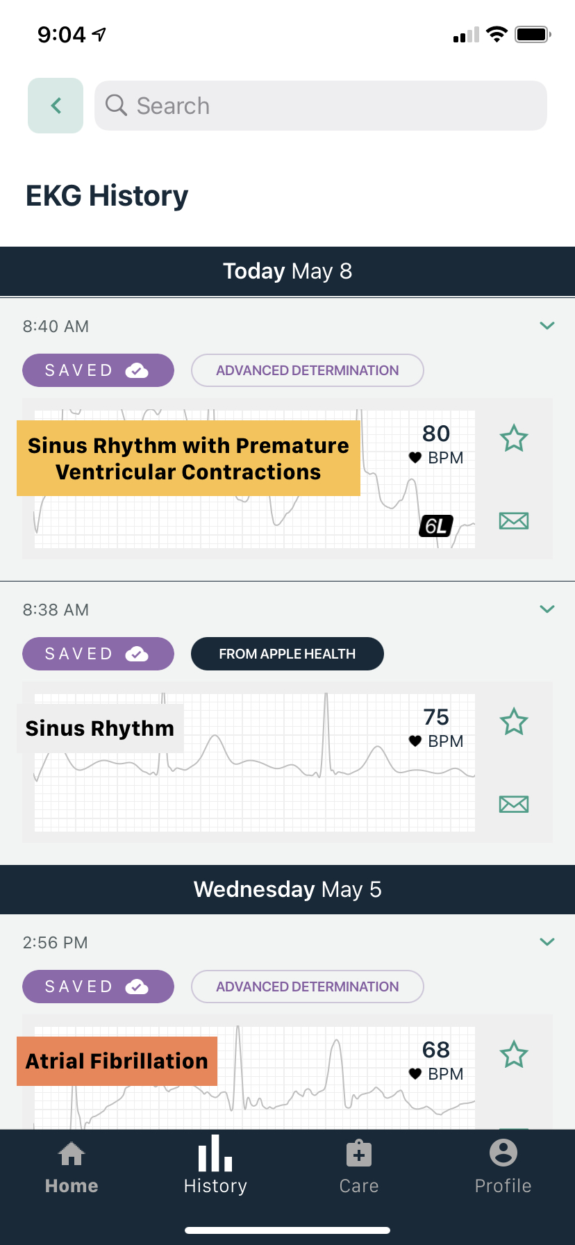 Apple Watch versus Kardia ECGs Both Appear in Your Kardia App But Only