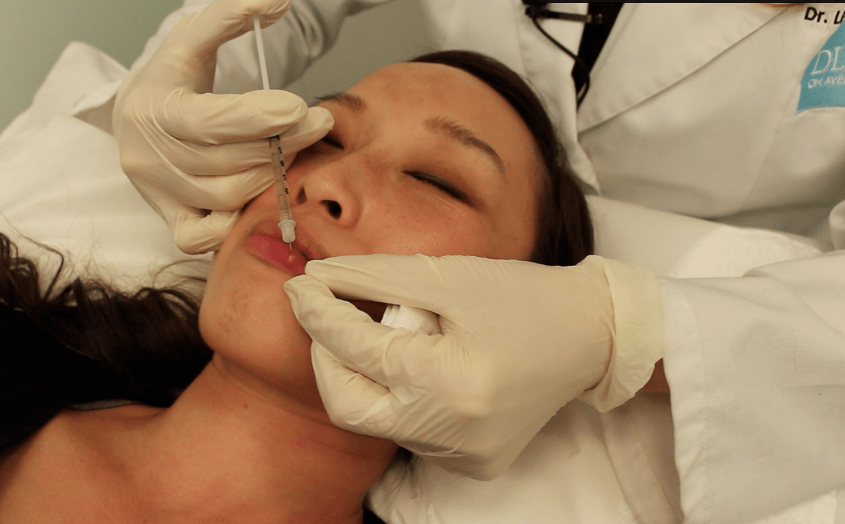 Lip Mole Removal The Skiny