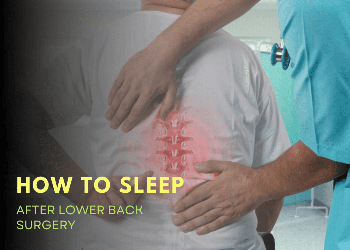 How To Sleep With Cervical Radiculopathy Sleep Savvy