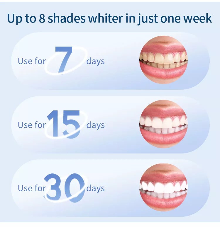 Ivismile Teeth Whitening Kit Complete LED Teeth Whitening Kit