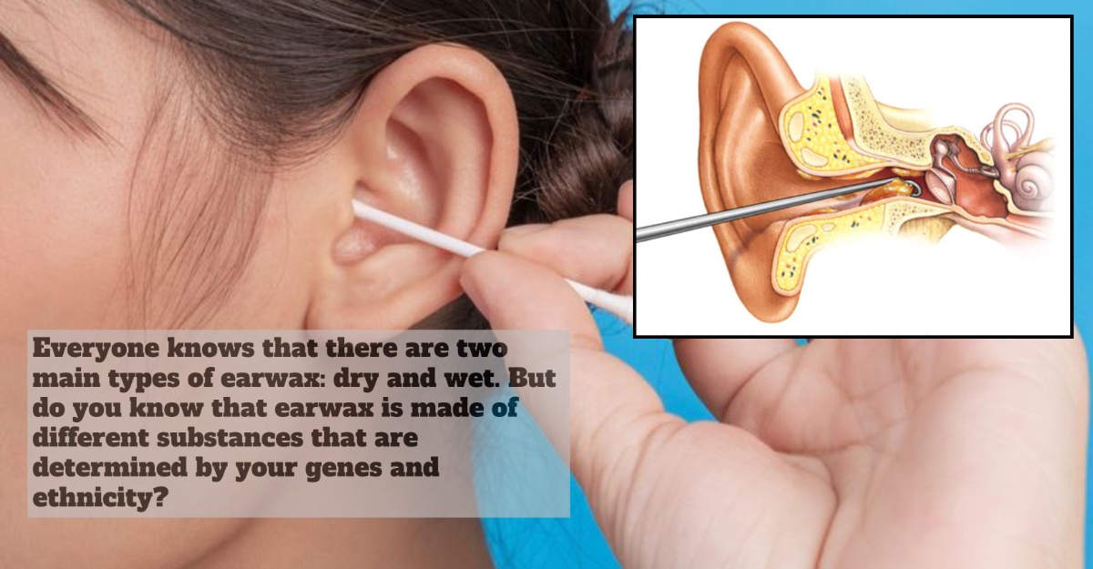 Dry Or Wet Earwax Determines If You Have Body Odor Or Not?