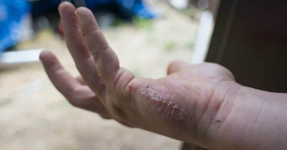 Super Glue Stuck On Hands Trend Meme