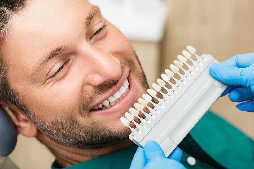 Top tips on getting dental veneers in Thailand Thaiger