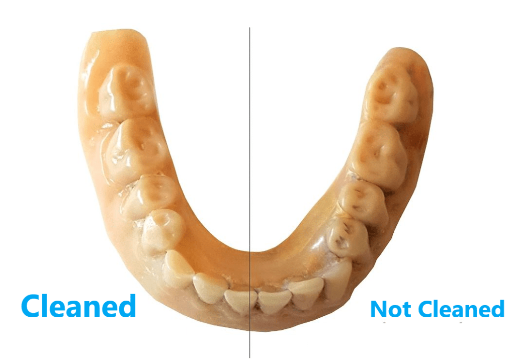 Top 10 Best Ultrasonic Denture Cleaner 2023 Reviews & Buying Guide