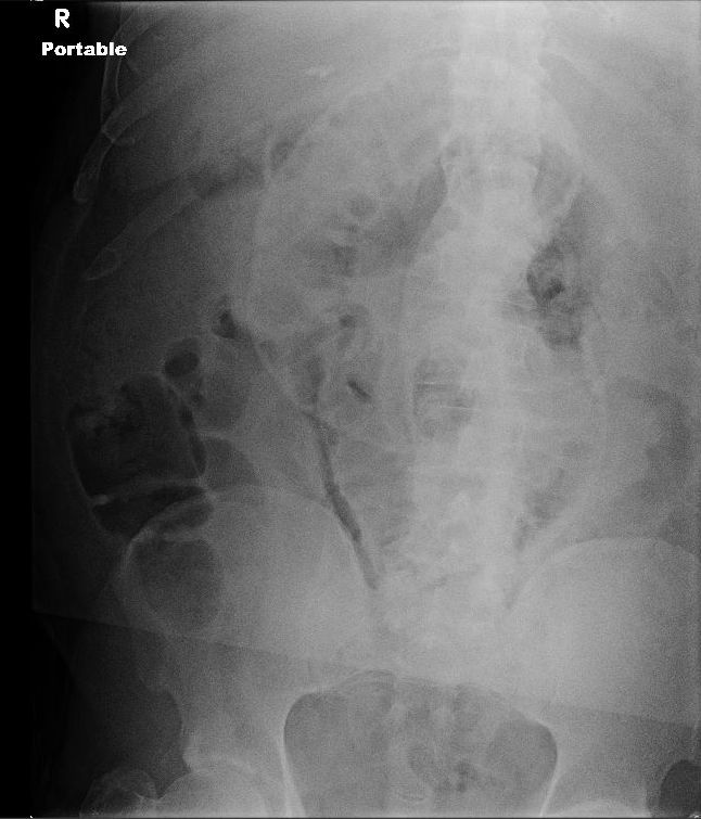 sponge The Trauma Pro