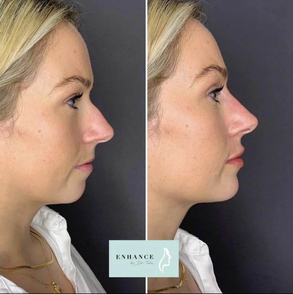 Dr Tara Francis The Tweakments Guide