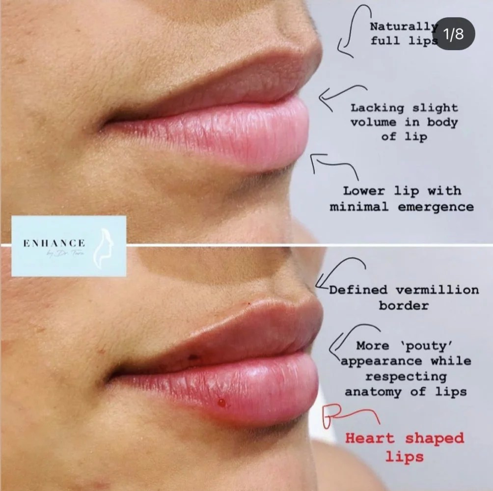 Dr Tara Francis The Tweakments Guide