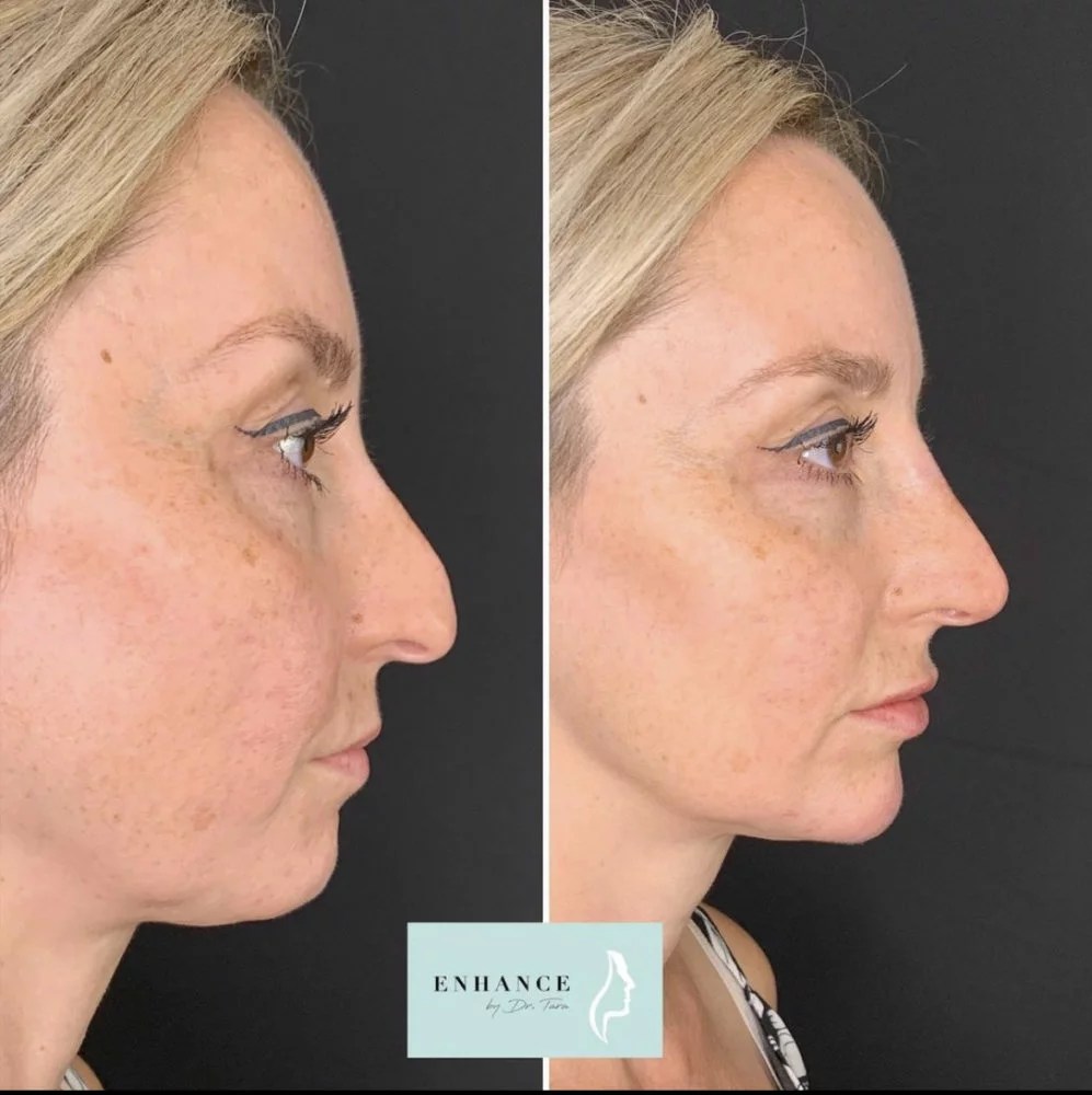 Dr Tara Francis The Tweakments Guide