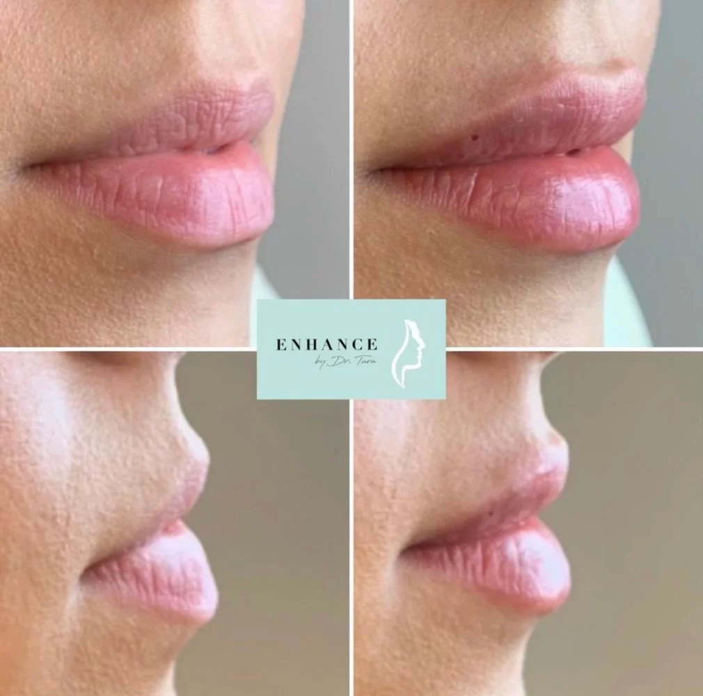 Dr Tara Francis The Tweakments Guide