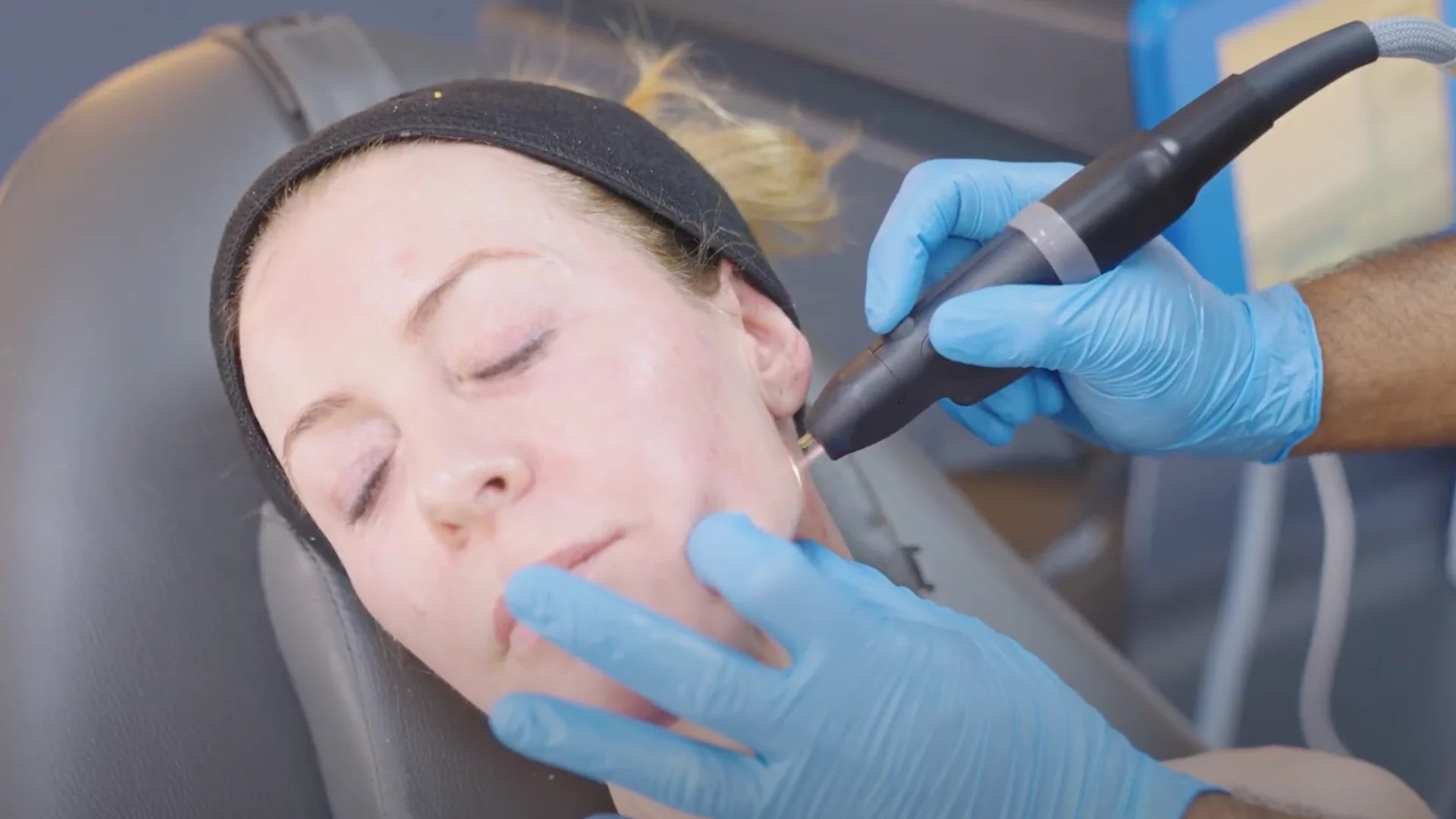 Alice tries NeoGen Plasma treatment The Tweakments Guide